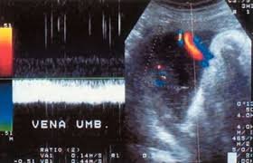 perfil_hermodinamico